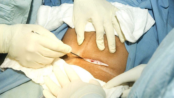 老婆马上要生孩子了,老公外地却回不去,让大姐陪产途中休克