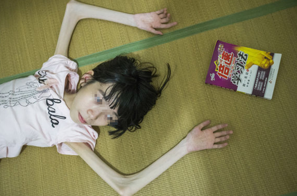 12岁女孩瘦成皮包骨父亲残忍抛弃她听说一消息后跪地求原谅