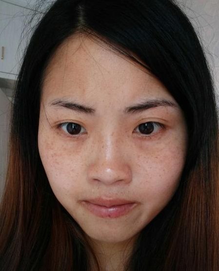 生完孩子脸上有斑绝不向黄褐斑投降2个妙招有效祛斑