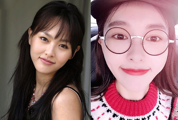 各脸型女星双眼皮贴出新高度