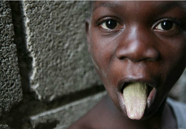 加勒比海北部的一个岛国,如今穷的吃泥土晒成的泥饼!