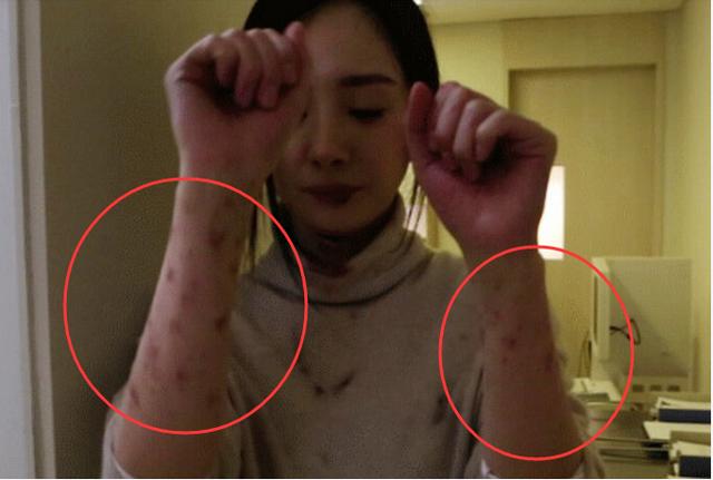 伤口吹了冷风会怎么样『伤口吹了冷风会怎么样吗』