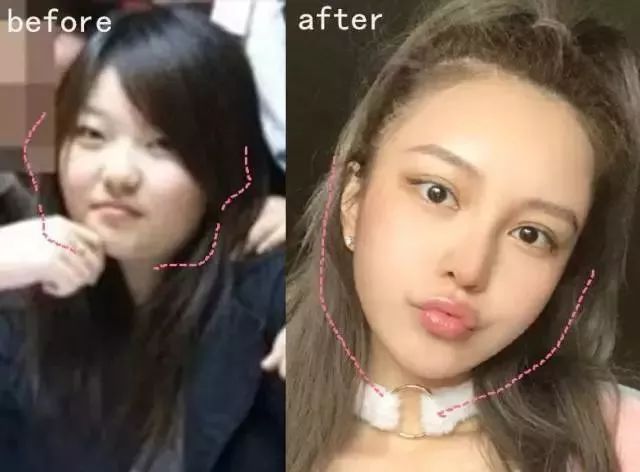 罗志祥又陷吸毒传闻周扬青整容过度两人都同居了还搞试婚