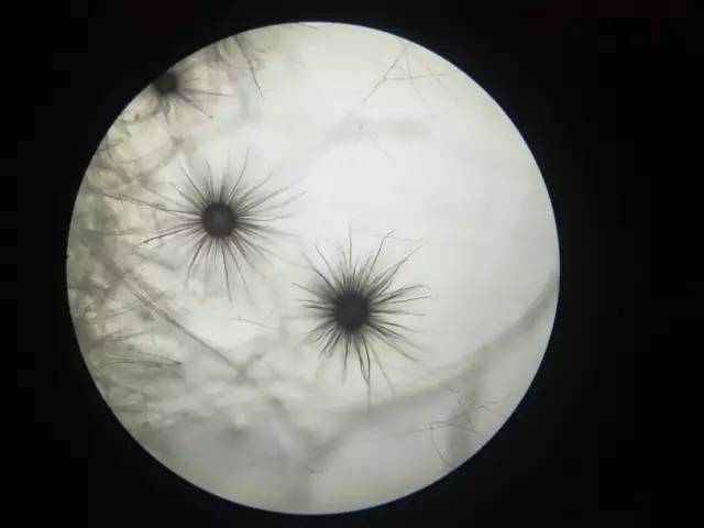 但也正是因为它工作环境潮湿阴冷,表面累积了很多霉菌,细菌,真菌.