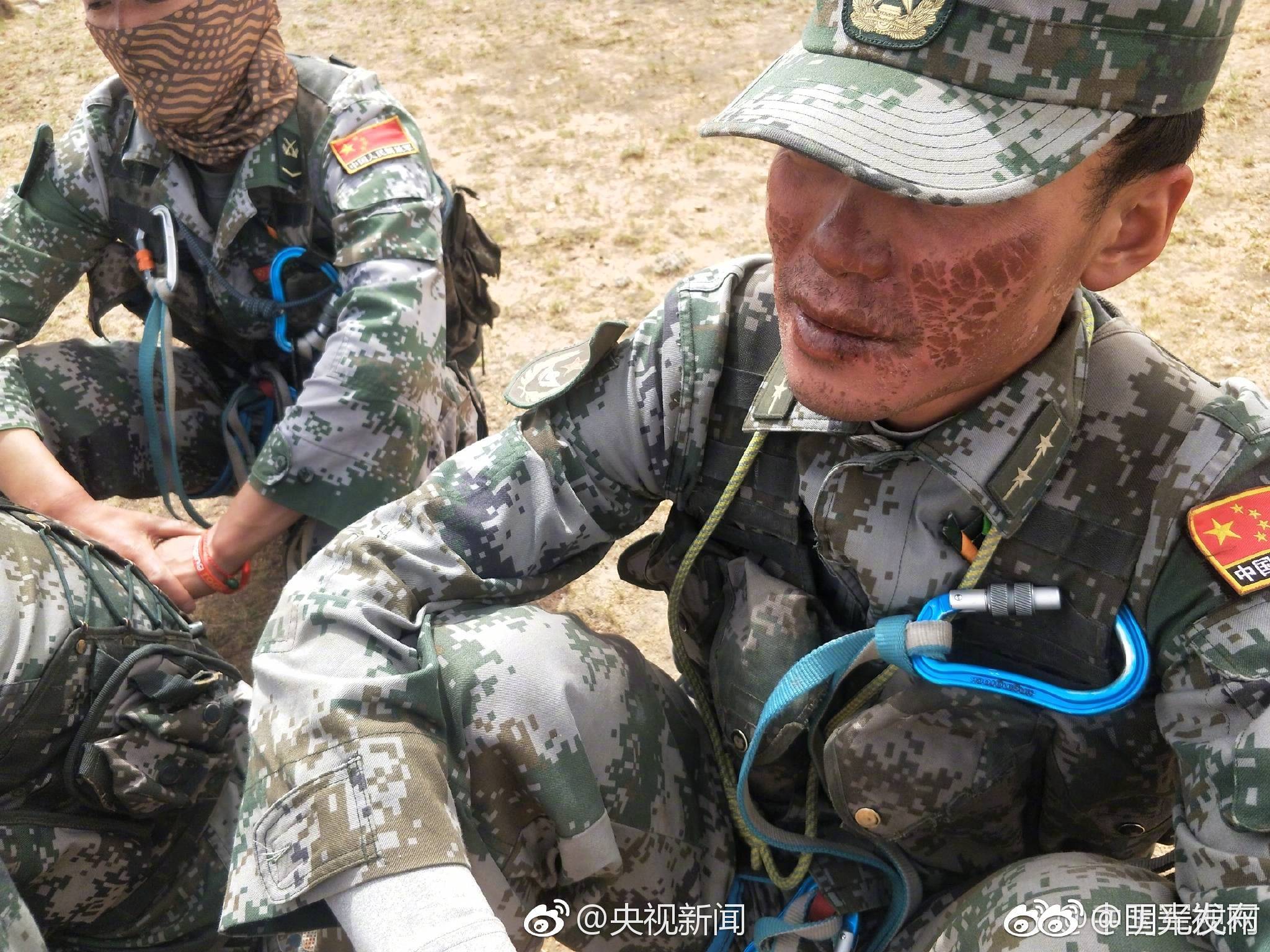 心疼[泪]这9张照片,你愿转发吗?让更多人认识他们!