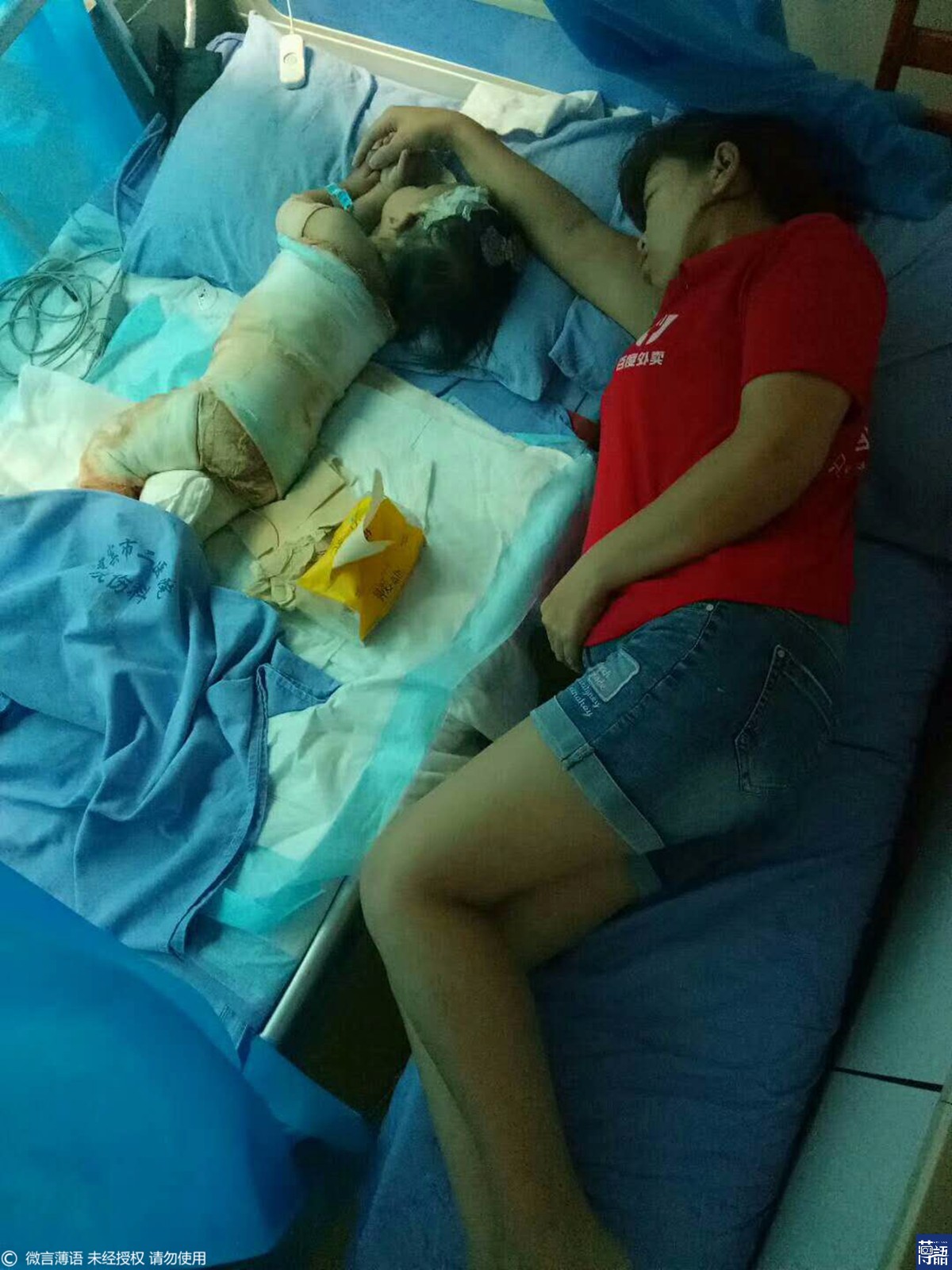 姥姥一个疏忽1岁女童跌入开水锅包成木乃伊妈妈当场哭晕