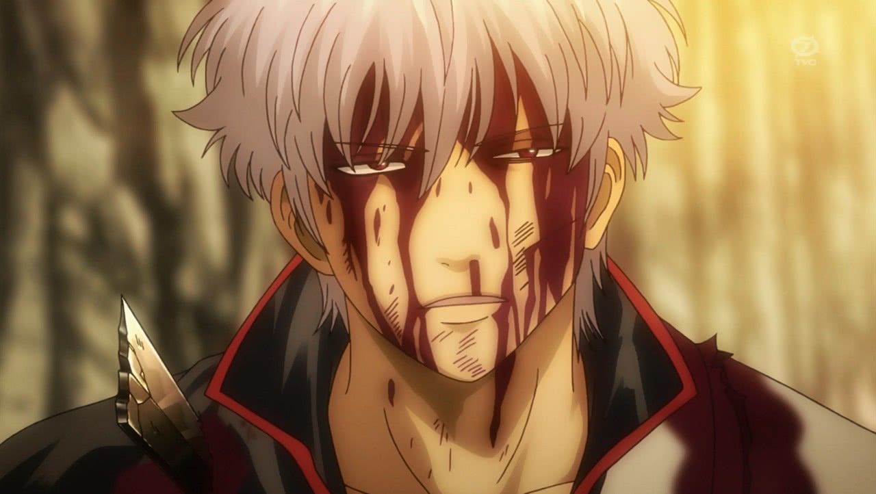 仍是幕府的通缉犯,罪名无非就是身为前攘夷志士至今还在和幕府作对