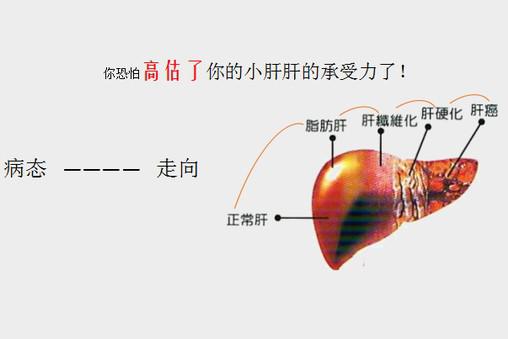 肝硬化的发病机制,你知道么?