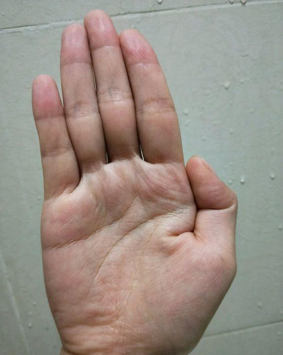 三角纹和十字纹同时出现健康问题要小心千万不可忽视