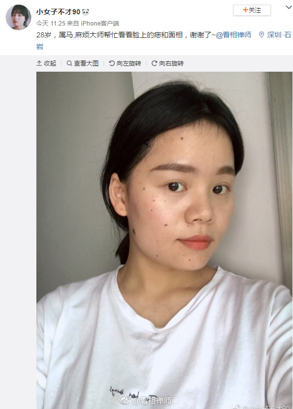 脸上痣多俗称痣多星痣也病也痣是体内毒素的体现