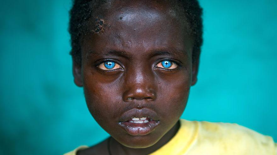 上帝遗忘的天使!上天给他一双美丽的蓝宝石眼睛,没想却被人嫌弃