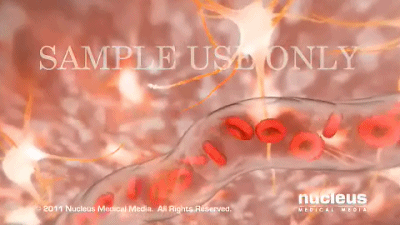 脑出血脑出血我们首选ct不要以为越贵的东西就越好,正所谓尺有所短寸