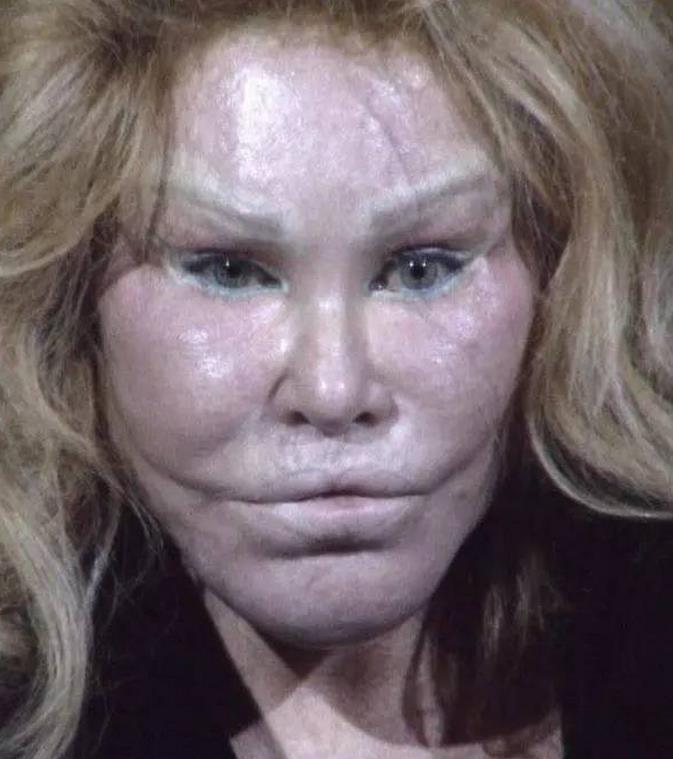 整容|猫女|乔斯林_新浪新闻