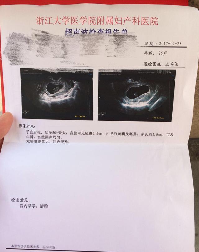 孕期必做的超声B超检查—顺产男宝宝,附B超检查报告单|B超检查|胎儿|报告单_新浪新闻