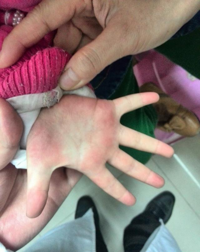 宝宝吃手指危害大!宝妈们该如何做呢?