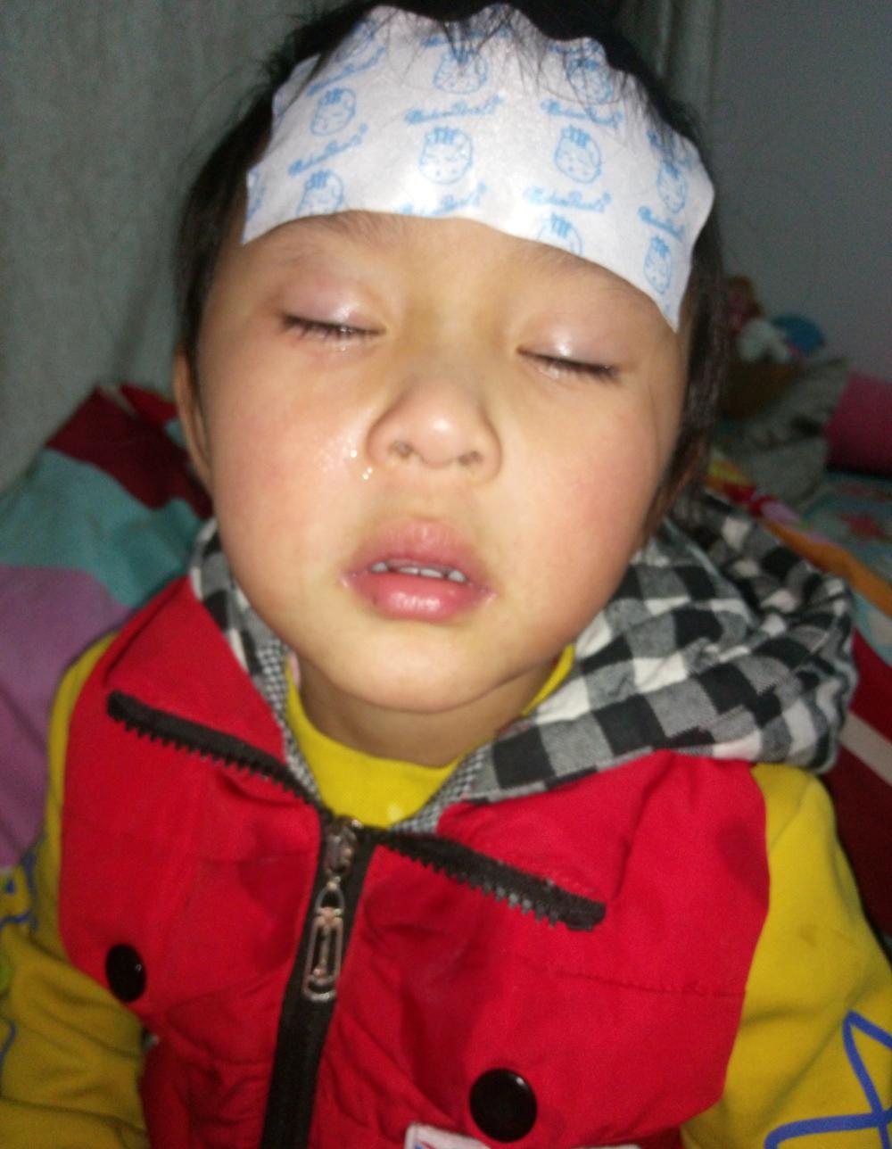 宝宝发烧的正确处理方法