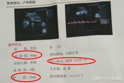 读懂b超单, 你就能猜到自己怀的是男孩还是女孩了|b超单|胎儿|孕囊