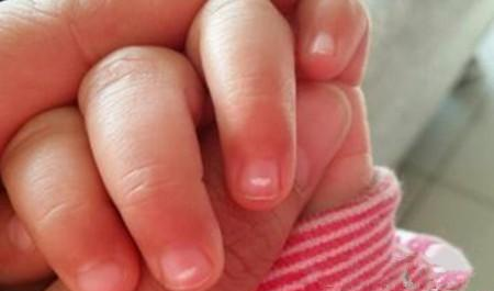 宝宝肚子长满虫子都不知道!宝宝有蛔虫有哪些表现?