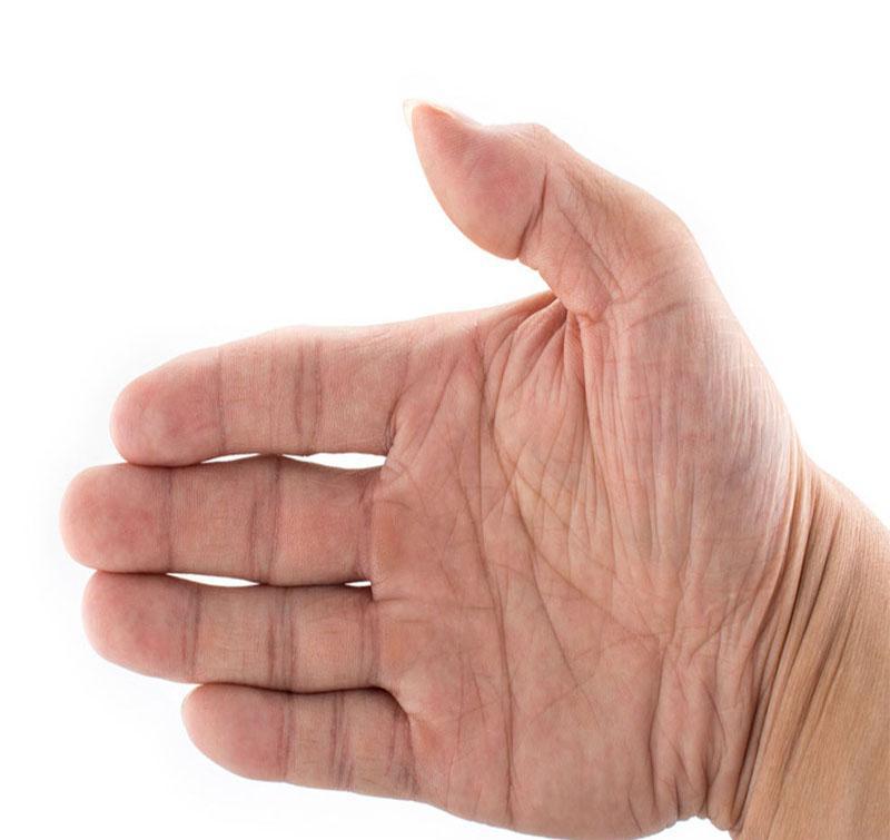 若是手指无肉,手指之间不能相贴且有露缝,好似竹节一样,这样可是留不