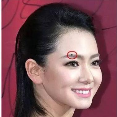 这三个地方有痣, 一个痣比一个痣值钱, 富贵有余