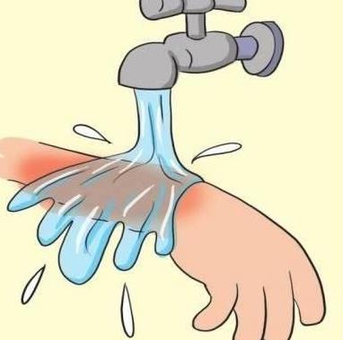 3岁男孩不小心烫伤,外婆这样做雪上加霜,烫伤处理这样才安全