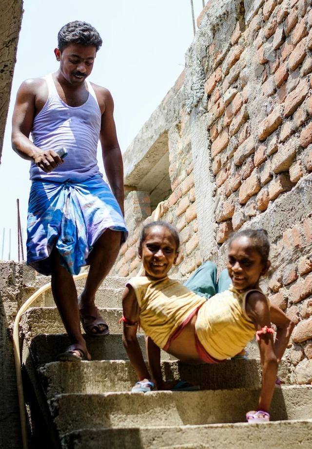 连体双胞胎姐妹共嫁一个老公盼望老天能赐给她们孩子