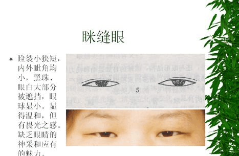 中国人普遍的三种眼型, 原来大多男的都是杏仁眼啊