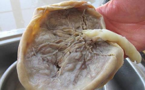 胎盘这样处理对宝宝有大好处妈妈都后悔知道的太晚了