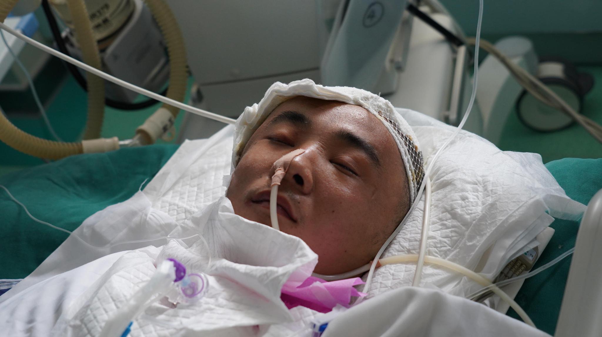 妈妈不怕有我呢看着病危的哥哥河南13岁女孩决定弃学救哥