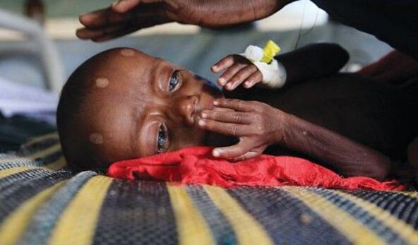 这儿的孩子骨瘦如柴,有东西吃就不哭,可有很多孩子死在母亲怀里