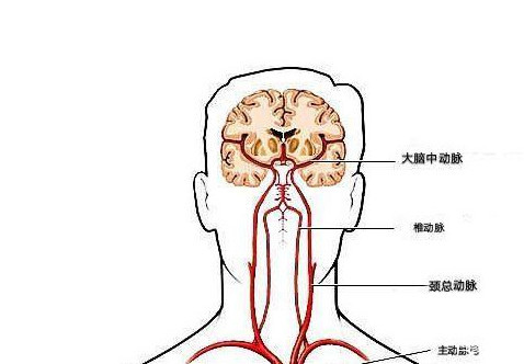 颈动脉堵塞,身体的哪个部位反应最明显?