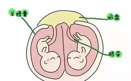 双胞胎在妈妈肚子里是什么样的? 是合住在一起还是住单间?