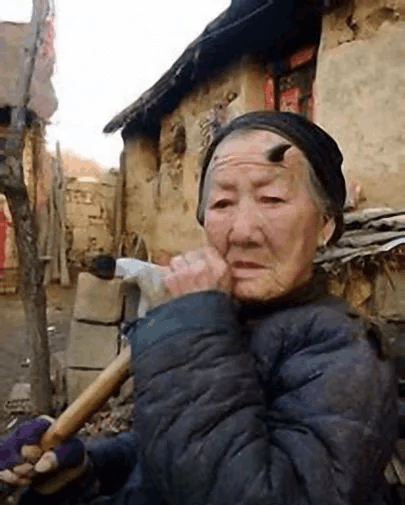 百岁老人头上长有犄角, 急救医生都被吓了1跳