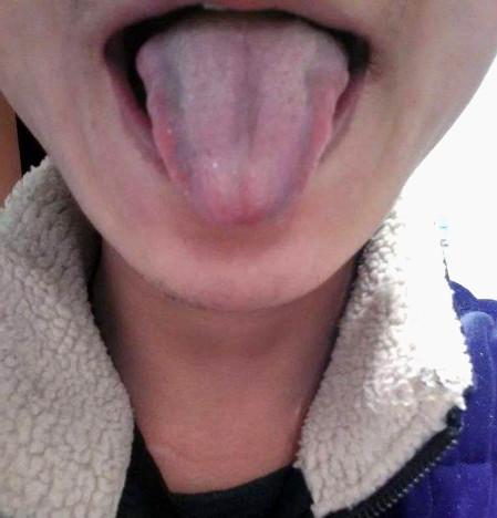 心脏好不好看舌头如果没有这4个现象恭喜你的心脏还很健康