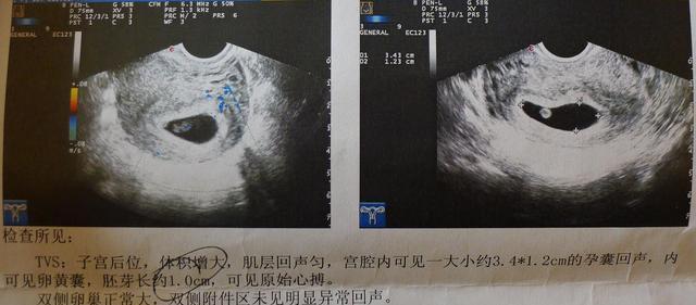 怀孕8周即可知胎儿性别, 其实这些早就提醒妈妈了
