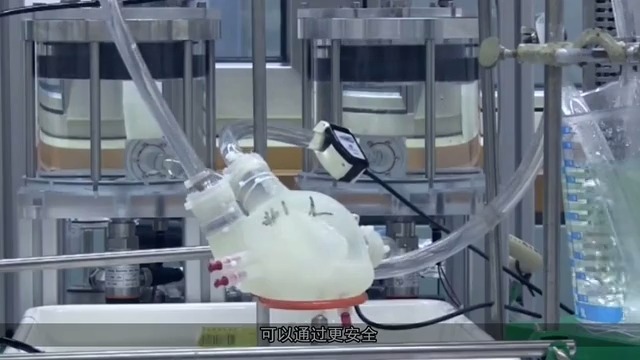 医学3D动画演示:心脏冠脉支架放置过程