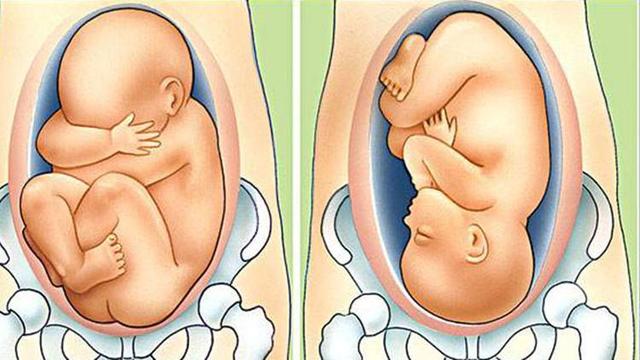 胎儿粗隆间径示意图图片
