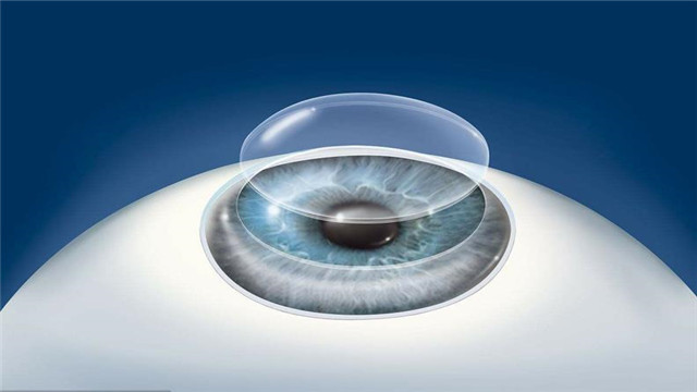 中国利用猪眼角膜打造高科技人工角膜,未来失明人群有望重获光明