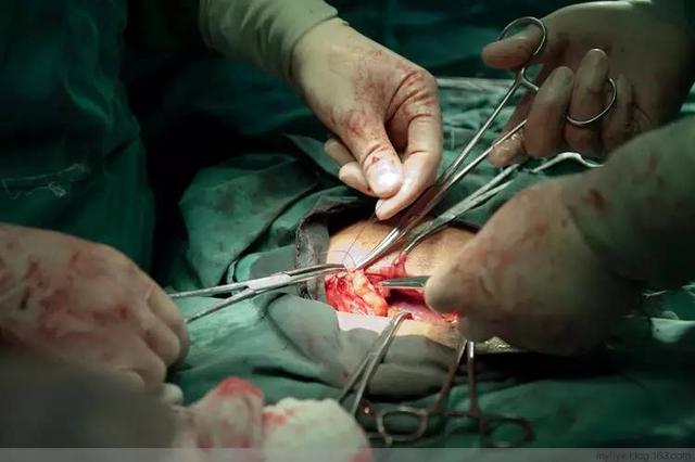 直击剖腹产过程现场,触目惊心的100张照片|手术|剖腹产|伤口_新浪新闻