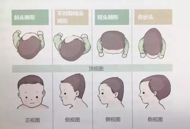 这个问题不纠正, 孩子将来大小眼,脸歪斜, 可就糟啦!