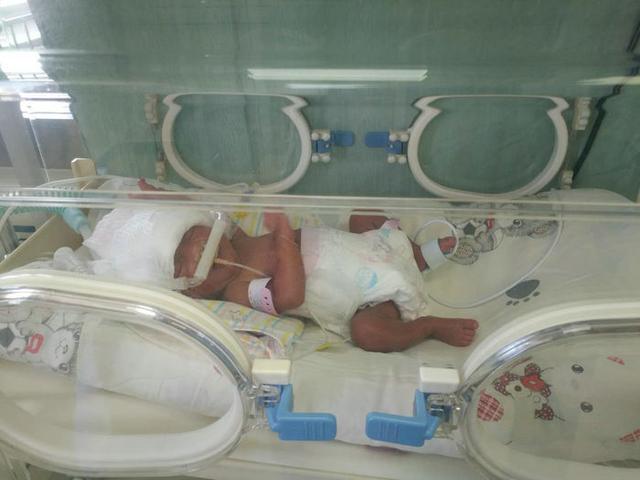 市妇幼院成功救治胎龄31周,仅1360克的极低出生体重高危早产儿