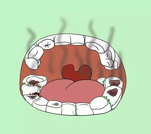 早上起床后口干口苦有异味可能暗示5种病别想得太简单