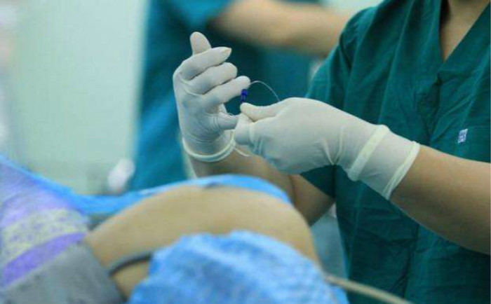 女性生孩子前,必须做件事,看着很尴尬但对妈妈和宝宝都有利