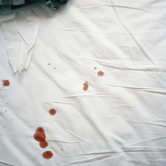 床单发黄有血渍用这两个东西泡一泡搓一搓立刻洁净如新