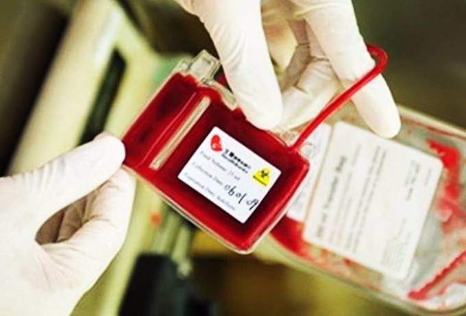 都说宝宝脐带血有用,父母知道具体如何保存吗?