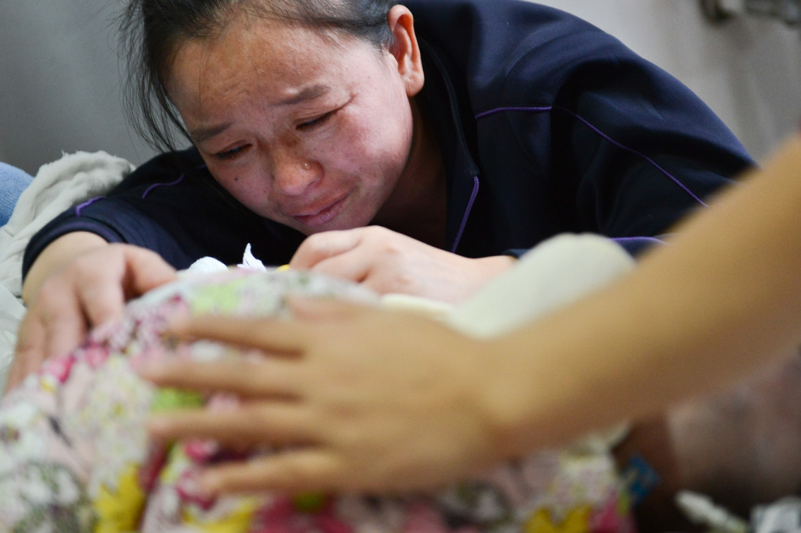 她不顾医生建议冒险胞胎,连体婴儿诞生后遭受磨难