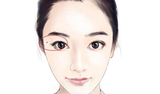 又俗称为太阳穴,又被称为迁移宫,主管在外求财的情况,若是痣长的右边