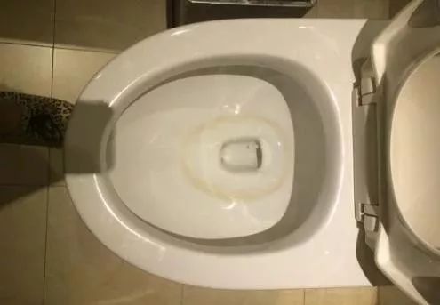 马桶上有尿渍又臭又黄?教你几招,马桶立刻焕然一新