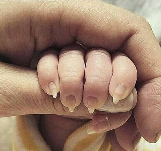 指甲|宝宝|嵌甲_新浪新闻