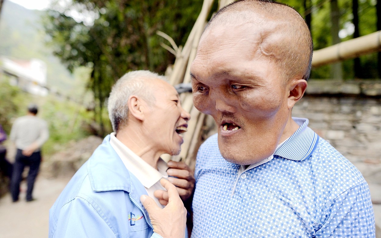 只要是人,都渴望洞房花烛,娶妻生子,重庆万州区长岭镇老土村的"大脑壳